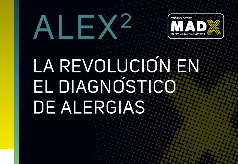 alex2