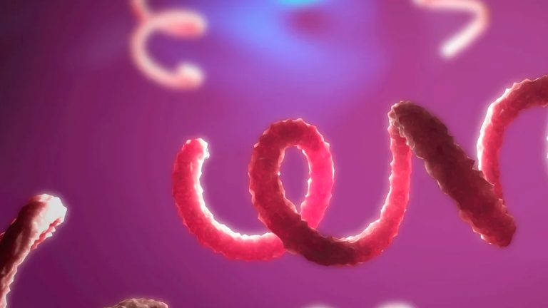 Infección de transmisión sexual (ITS): Sífilis